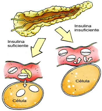 Insulina-cast